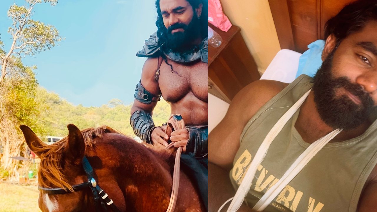 ”ශූටින් අන්තිම දවසෙ, විදුලි වේගෙන් අස්සයා පැදගෙන ඇවිත් අත කඩාගත්තා”