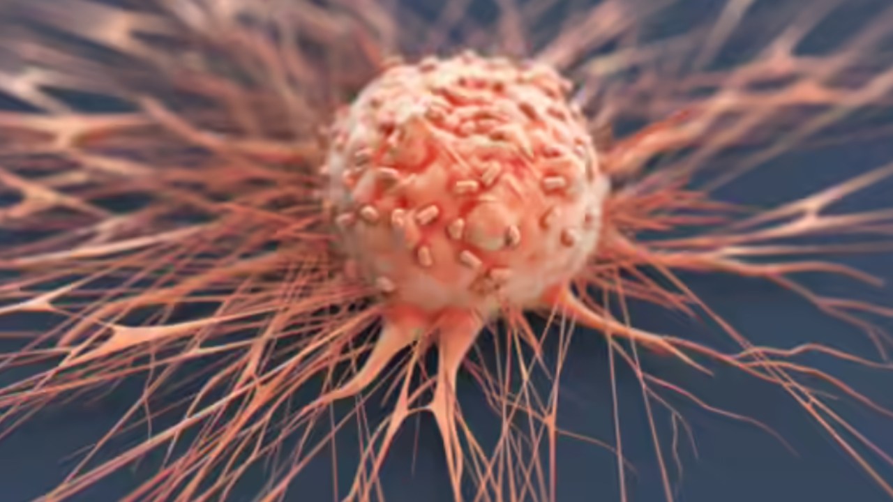 භයානක හෙළිදරව්වක් – නොරොච්චෝලේ නිසා පිළිකා අවදානමක් – විශේෂඥ වෛද්‍ය කියයි